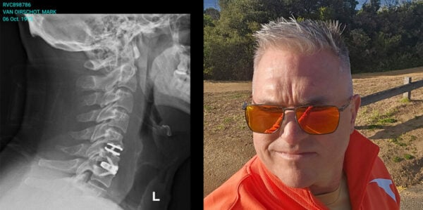 Scan von Marks Nackenverletzung